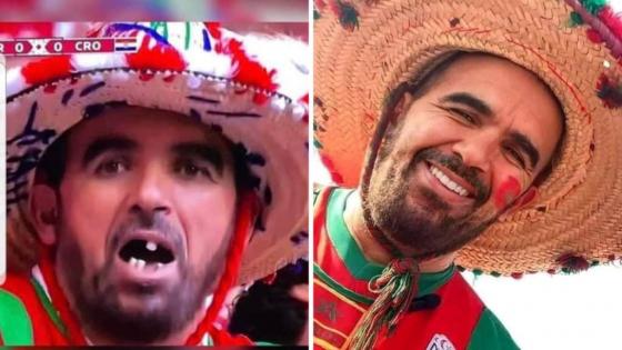 صورة المشجع المغربي بابتسامة جديدة “فوطوشوب” وطبيب من دبي يتكفل بحالته وبمصاريف سفره من الدوحة إلى دبي