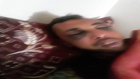 كسور خطيرة بوجه الحكم عماد زوهار بعد الاعتداء عليه بمدخل شاطئ آسفي