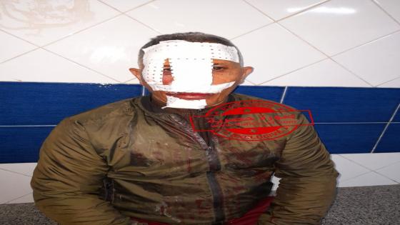 بالصور: نجاة شاب من موت محقق بعد سقوطه رفقة دراجته النارية داخل بالوعة للوادي الحار بآسفي