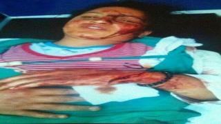 صادم…شكوك حول التحقيق في الاعتداء ومحاولة اغتصاب تلميذة باقليم آسفي