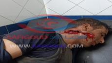 صورة حصرية: نجاة شاب من موت محقق بعد تلقيه رصاصة طائشة بجماعة البدوزة