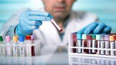 خطوة احترازية..لجنة اليقظة بآسفي توصي بإجراء تحاليل مخبرية على مستخدمي شركات ومتاجر كبرى بالإقليم