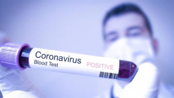 المغرب يرفع عدد تحاليل الكشف عن فيروس كورونا ويجري 2241 خلال الأسبوع الأخير