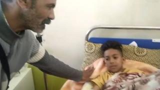 عملية ختان لمريضين بنزف الدم “الهيموفيليا” بآسفي