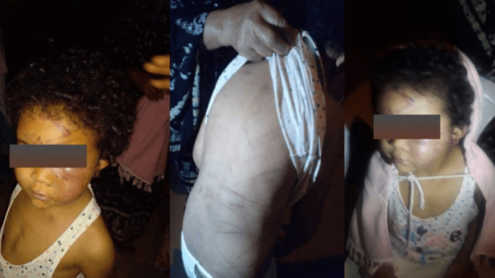 صور وفيديو لأم تعذب ابنتها بطريقة وحشية تهز حيا شعبيا بأكادير