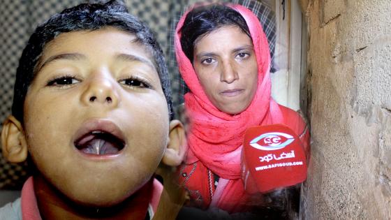 فيديو : هاد الشي واقع في آسفي…خاصو 60 ألف ريال صافي باش يولي يهضر لأن لسانو لاصق والطبيب جرا عليه