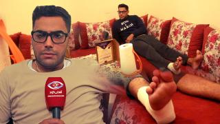 فيديو : فنان من آسفي..فيدورات فندق فرح سلخوني وهرسوني من رجلي