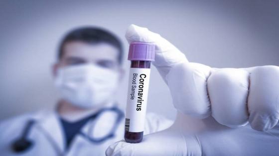 المغرب يسجل 190 إصابة جديدة بفيروس كورونا و30 حالة شفاء خلال 24 ساعة