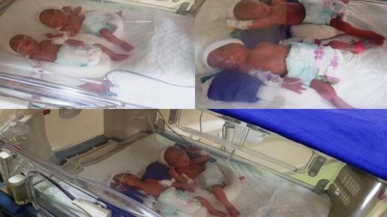 بالصوت والصورة : ها كيفاش ولادات امرأة حامل بالشماعية 6 توائم بعدما كانت كتعتقد غادي تولد 4 فقط