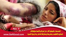 فيديو :الصدمة… شوفوا أش دار لمراتو لأنها مابغاتش تعطيه الفلوس وضربها بمطرقة قدام جدارمية السبت