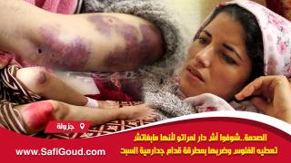 فيديو :الصدمة… شوفوا أش دار لمراتو لأنها مابغاتش تعطيه الفلوس وضربها بمطرقة قدام جدارمية السبت