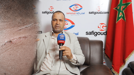 دموع الرجال ..سائق طاكسي يشتكي بطش زميل له بمحطة آسفي ويناشد مسؤولي الأمن الوطني