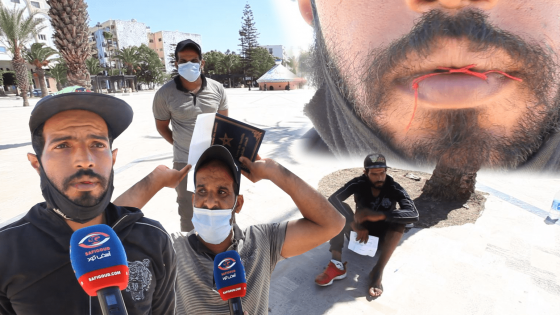 شاب يخيط فمه ويضرب عن الطعام إحتجاجا على إقصائه من الحصول على فرصة شغل