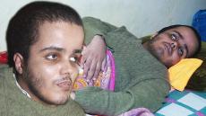 صادم … شاب عندو مرض غريب ووالده يناشد المحسنين : عييت ما نجري بيه و في سبيطار آسفي تا واحد ما تسوقني